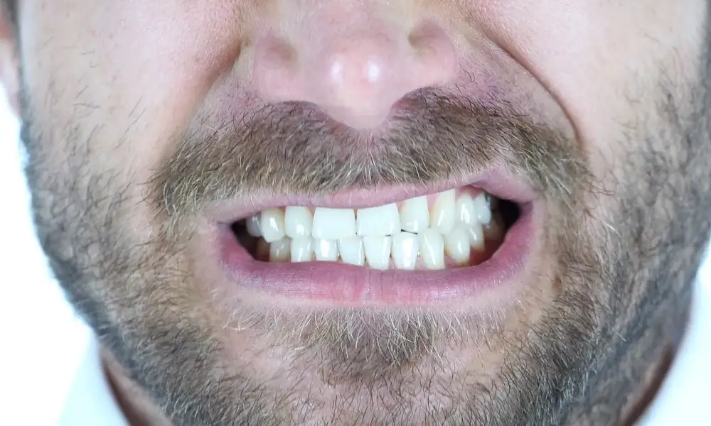 تجاهل هذه العلامات قد يكلفك أسنانك وصحتك 