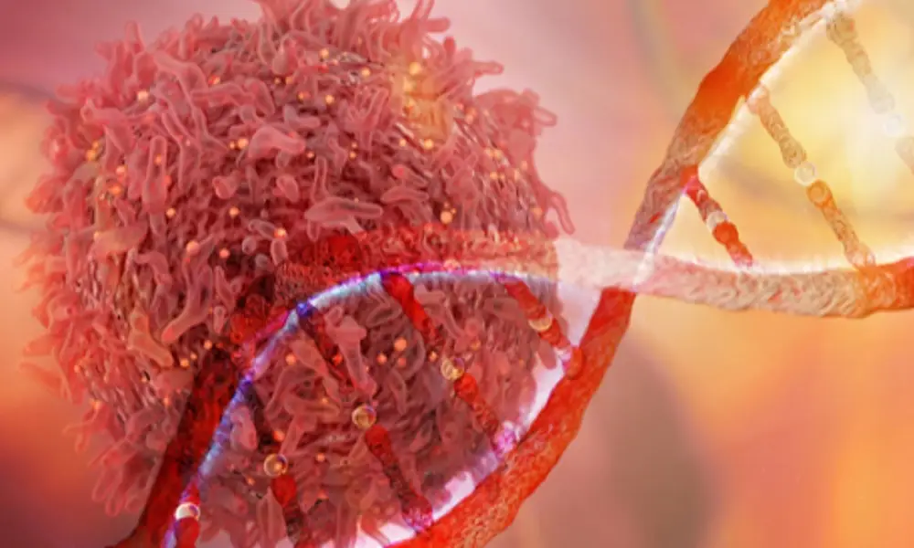 كل ما تحتاج معرفته عن سرطان المرحلة الصفرية، وأسباب ندرة تشخيصه 
